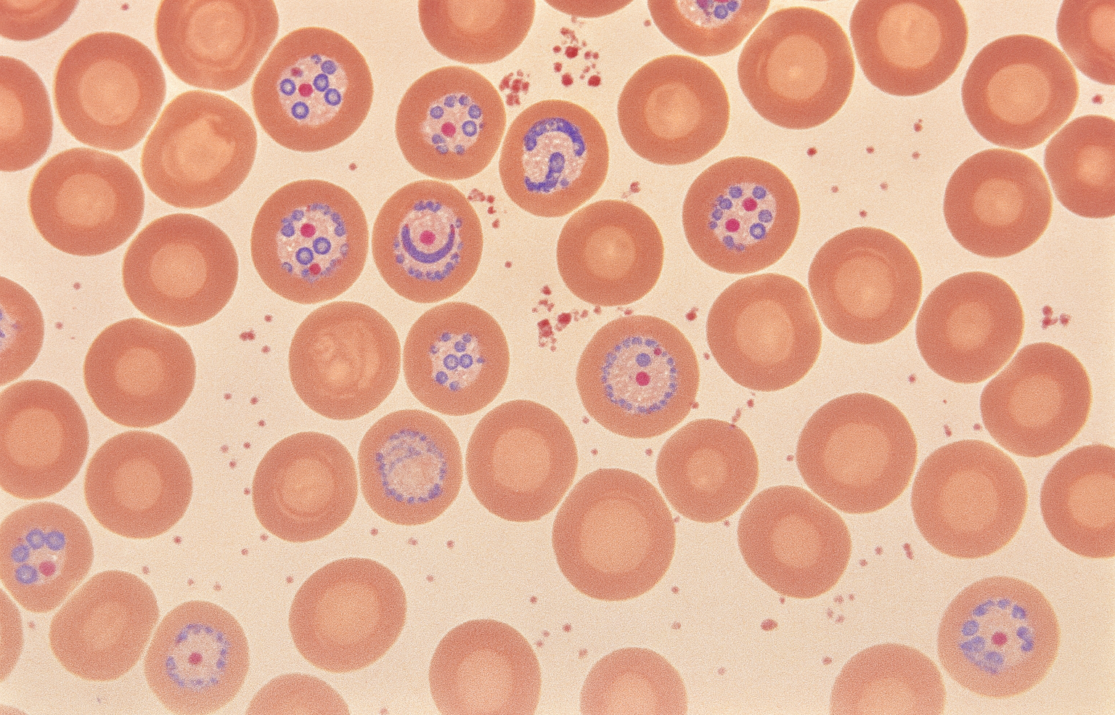 Mecanismos biológicos de la malaria