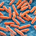 Lepra y estigma: una batalla en pleno siglo XXI