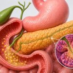 Lipasa pancreática: qué es, función y valores normales