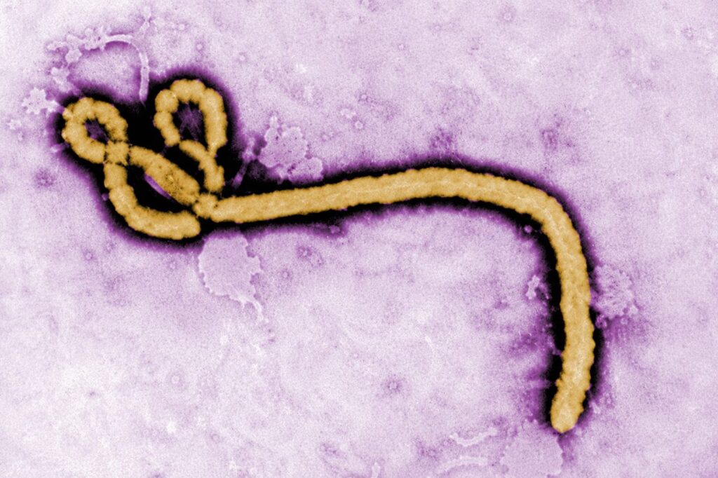 Enfermedad por el virus Ébola
