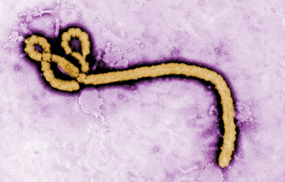 Enfermedad por el virus Ébola