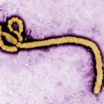 Enfermedad por el virus Ébola: estructura viral y relevancia médica