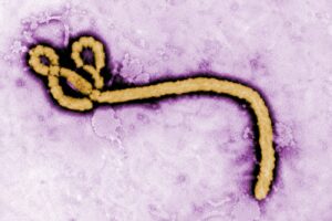 Enfermedad por el virus Ébola